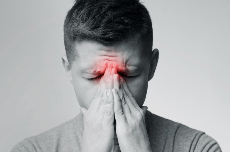 sinusitis